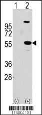 Anti-ALDH1A1 Rabbit Polyclonal Antibody