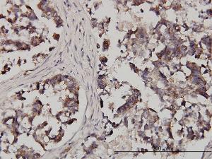 Anti-FXR1 Mouse Monoclonal Antibody [clone: 2G11]