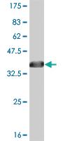 Anti-ABL2 Mouse Monoclonal Antibody [clone: 3E4]