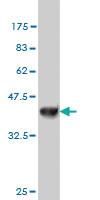 Anti-NDST3 Mouse Monoclonal Antibody [clone: 5B9]