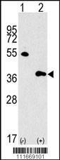 Anti-MLST8 Rabbit Polyclonal Antibody (AP (Alkaline Phosphatase))