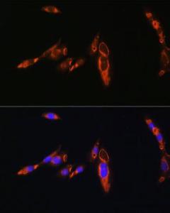 Immunofluorescence analysis of NIH/3T3 cells using Anti-AVPR1A / V1aR Antibody (A10419) at a dilution of 1:100. DAPI was used to stain the cell nuclei (blue).