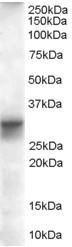 Anti-FHL1 Antibody (A82486) (0.01 µg/ml) staining of Human Heart lysate (35 µg protein in RIPA buffer). Primary incubation was 1 hour. Detected by chemiluminescence