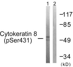 Western blot analysis of lysates from 293 cells treated with EGF 200ng/ml 30' using Anti-Keratin 8 (phospho Ser432) Antibody. The right hand lane represents a negative control, where the antibody is blocked by the immunising peptide.