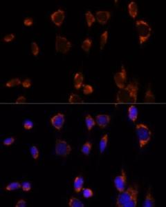 Immunofluorescence analysis of NIH-3T3 cells using Anti-PDHA1 Antibody (A305843) at a dilution of 1:100. DAPI was used to stain the cell nuclei (blue)