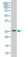 Anti-RPL13 Mouse Monoclonal Antibody [clone: 3F6]