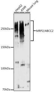 Western blot analysis of extracts of various cell lines, using Anti-MRP2 Antibody (A10420) at 1:1,000 dilution. The secondary antibody was Goat Anti-Rabbit IgG H&L Antibody (HRP) at 1:10,000 dilution.