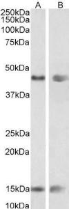 Antibody anti-PNPLA3 100 µg