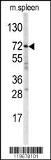 Anti-ABCG1 Rabbit Polyclonal Antibody