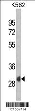 Anti-SFRP1 Rabbit Polyclonal Antibody