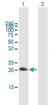 Anti-RGS10 Mouse Polyclonal Antibody