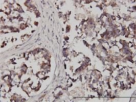 Anti-FXR1 Mouse Monoclonal Antibody [clone: 2G11]