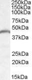 Antibody anti-PNPLA3 100 µg