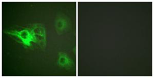 Immunofluorescence analysis of HeLa cells using Anti-Keratin 8 (phospho Ser432) Antibody. The right hand panel represents a negative control, where the antibody was pre-incubated with the immunising peptide.