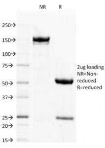 SDS-PAGE analysis of Anti-Filaggrin Antibody [FLG/1563] under non-reduced and reduced conditions; showing intact IgG and intact heavy and light chains, respectively SDS-PAGE analysis confirms the integrity and purity of the antibody