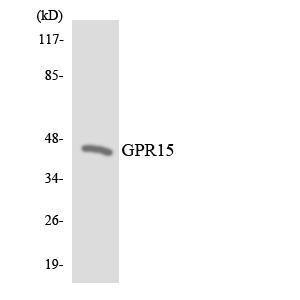 Anti-GPCR GPR15 Rabbit Polyclonal Antibody