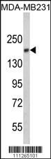 Anti-EGFR Rabbit Polyclonal Antibody