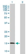 Anti-ZNHIT1 Mouse Polyclonal Antibody