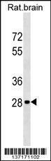 Anti-HOXD9 Rabbit Polyclonal Antibody (HRP (Horseradish Peroxidase))