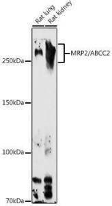 Western blot analysis of extracts of various cell lines, using Anti-MRP2 Antibody (A10420) at 1:1,000 dilution. The secondary antibody was Goat Anti-Rabbit IgG H&L Antibody (HRP) at 1:10,000 dilution.