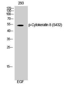 Western blot analysis of 293 cells using Anti-Keratin 8 (phospho Ser432) Antibody