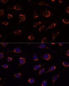 Immunofluorescence analysis of U-2 OS cells using Anti-PDHA1 Antibody (A305843) at a dilution of 1:100. DAPI was used to stain the cell nuclei (blue)