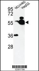 Anti-ALDH1A1 Rabbit Polyclonal Antibody