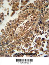 Anti-FSCN3 Rabbit Polyclonal Antibody