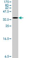 Anti-SAT1 Mouse Polyclonal Antibody