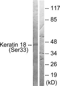 Western blot analysis of lysates from HT29 cells using Anti-Keratin 18 (phospho Ser33) Antibody. The right hand lane represents a negative control, where the antibody is blocked by the immunising peptide