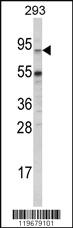 Anti-ABCG1 Rabbit Polyclonal Antibody