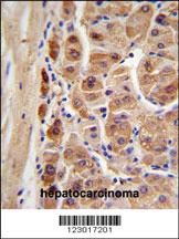 Anti-ALDH1A1 Rabbit Polyclonal Antibody