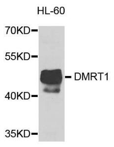 Western blot analysis of extracts of HL-60 cells, using Anti-DMRT1 Antibody (A8411) at 1:1,000 dilution