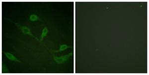 Immunofluorescence analysis of HeLa cells using Anti-Keratin 18 (phospho Ser33) Antibody. The right hand panel represents a negative control, where the antibody was pre-incubated with the immunising peptide