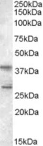 EB05356 (0.5 µg/ml) staining of Jurkat lysate (35 µg protein in RIPA buffer).  Primary incubation was 1 hour.  Detected by chemiluminescence.