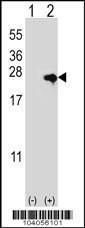 Anti-Nucleoside Diphosphate Kinase D Rabbit Polyclonal Antibody (Biotin)