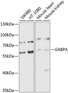 Anti-GABPA Rabbit Polyclonal Antibody