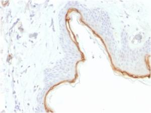 Immunohistochemical analysis of formalin-fixed, paraffin-embedded human skin using Anti-Filaggrin Antibody [FLG/1945]