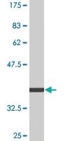 Anti-AAK1 Mouse Monoclonal Antibody [clone: 4B10]