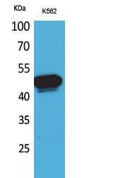 Western blot analysis of K562 cells using Anti-SERPINA4 Antibody