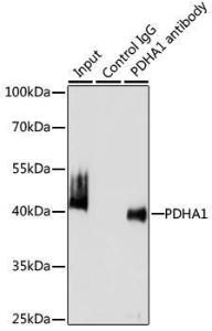 Immunoprecipitation analysis of 200 µg extracts of U-87MG cells using 3 µg of Anti-PDHA1 Antibody (A305843). This Western blot was performed on the immunoprecipitate using Anti-PDHA1 Antibody (A305843) at a dilution of 1:1000