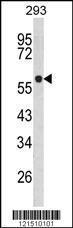 Anti-TPH1 Rabbit Polyclonal Antibody (Biotin)