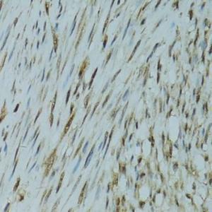 Anti-GABPA Rabbit Polyclonal Antibody