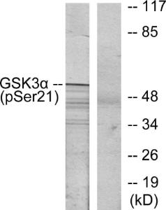 Western blot analysis of lysates from ovary cancer using Anti-GSK3 alpha (phospho Ser21) Antibody. The right hand lane represents a negative control, where the Antibody is blocked by the immunising peptide