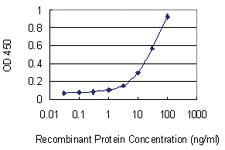 Anti-EZH2 Mouse Monoclonal Antibody [clone: 1D11]