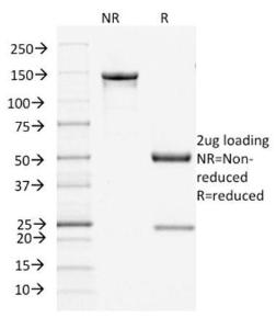 SDS-PAGE analysis of Anti-Filaggrin Antibody [FLG/1945] under non-reduced and reduced conditions; showing intact IgG and intact heavy and light chains, respectively. SDS-PAGE analysis confirms the integrity and purity of the antibody.