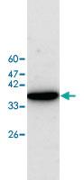 Anti-EIF5A Rabbit Polyclonal Antibody