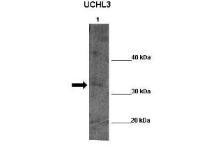 Anti-UCHL5 Rabbit Polyclonal Antibody