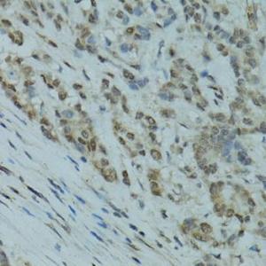 Anti-GABPA Rabbit Polyclonal Antibody