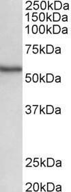 Anti-STK38 Antibody (A82492) (0.5 µg/ml) staining of Human Spleen lysate (35 µg protein in RIPA buffer). Primary incubation was 1 hour. Detected by chemilu minescence